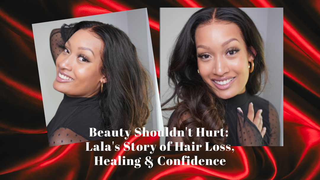 Beauty Shouldn't Hurt: Lala's Story of Hair Loss, Healing & Confidence