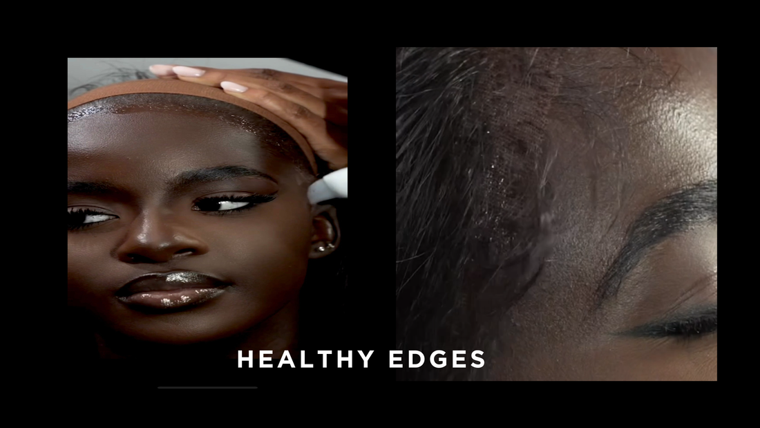 healthy-scalp-before-and-after-lace-install