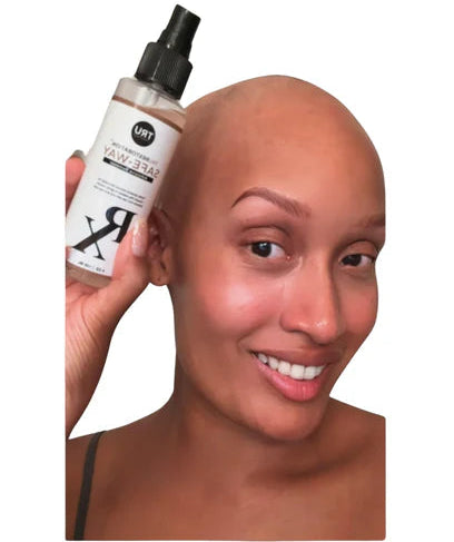 Alopecia