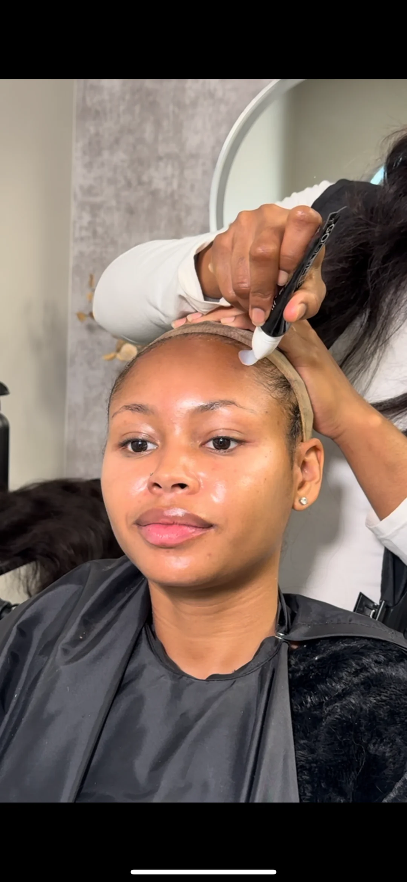 Edge/Hair Loss & Recovery